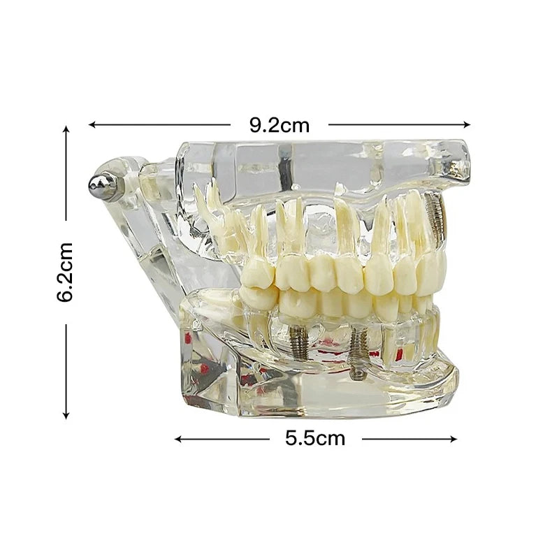 Dental Typodont Teeth Model for Medical education